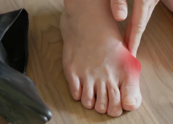 Illustration für Hallux valgus